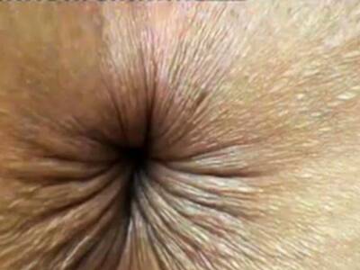 Close up butthole winking on vidgratis.com