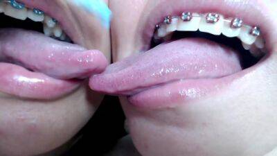 Deep tounge kissing between two brace lesbian on vidgratis.com